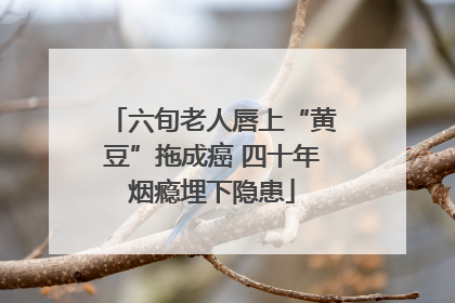六旬老人唇上“黄豆”拖成癌 四十年烟瘾埋下隐患
